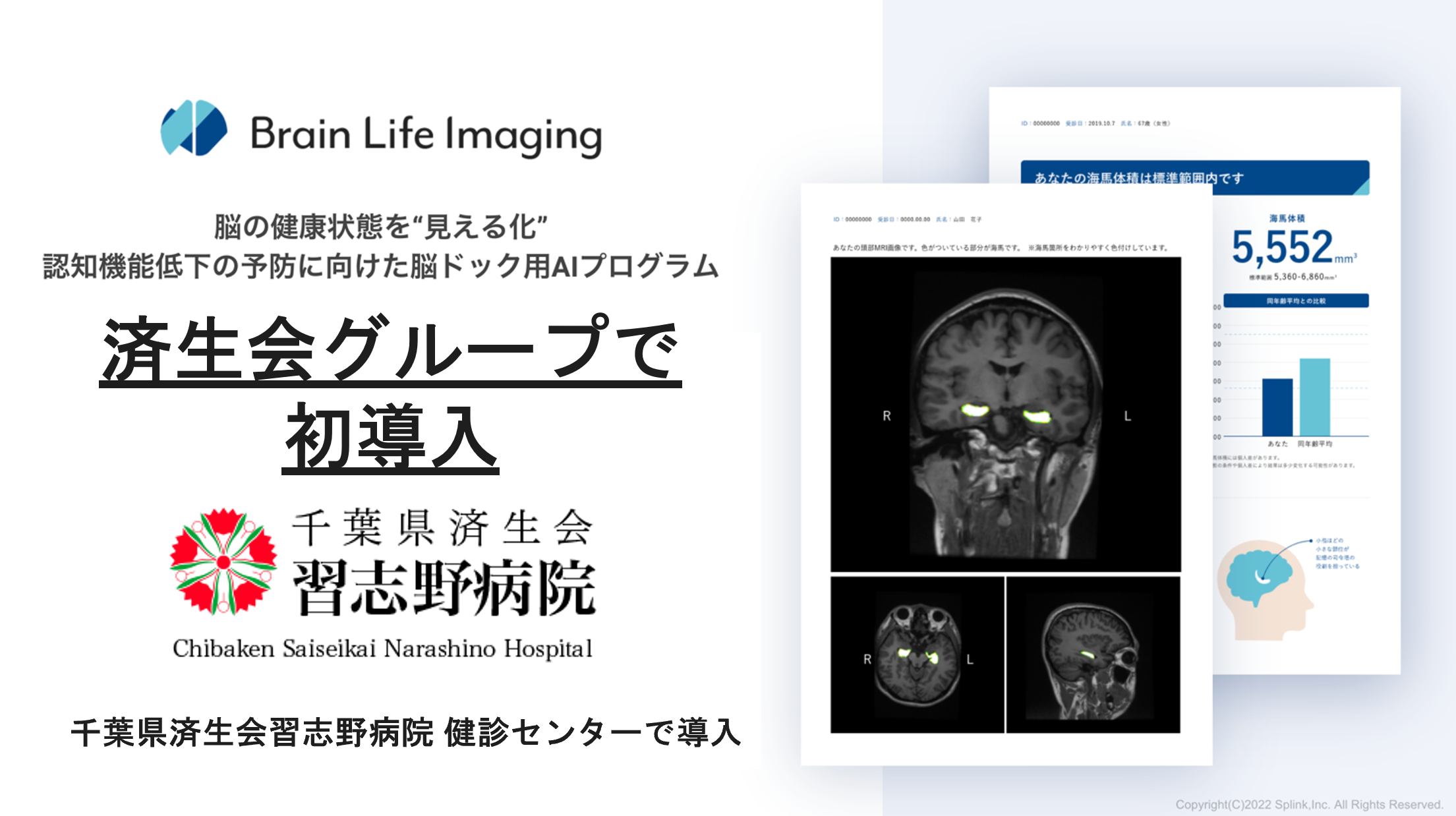 【済生会グループで初導入】脳ドック用AIプログラム「Brain Life Imaging」が千葉県済生会習志野病院 健診センターで導入