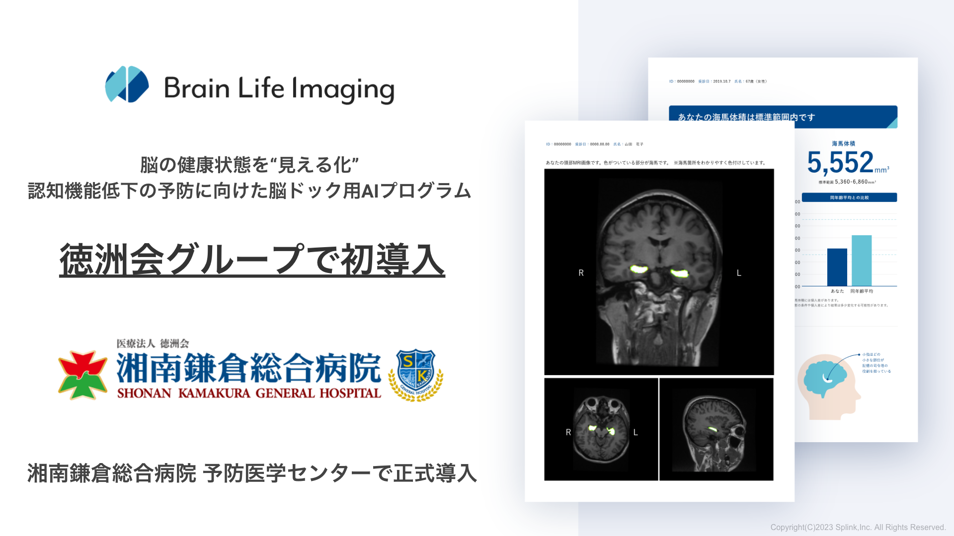 【徳洲会グループで初導入】脳ドック用AIプログラム「Brain Life Imaging」が湘南鎌倉徳洲会総合病院 予防医学センターで正式導入